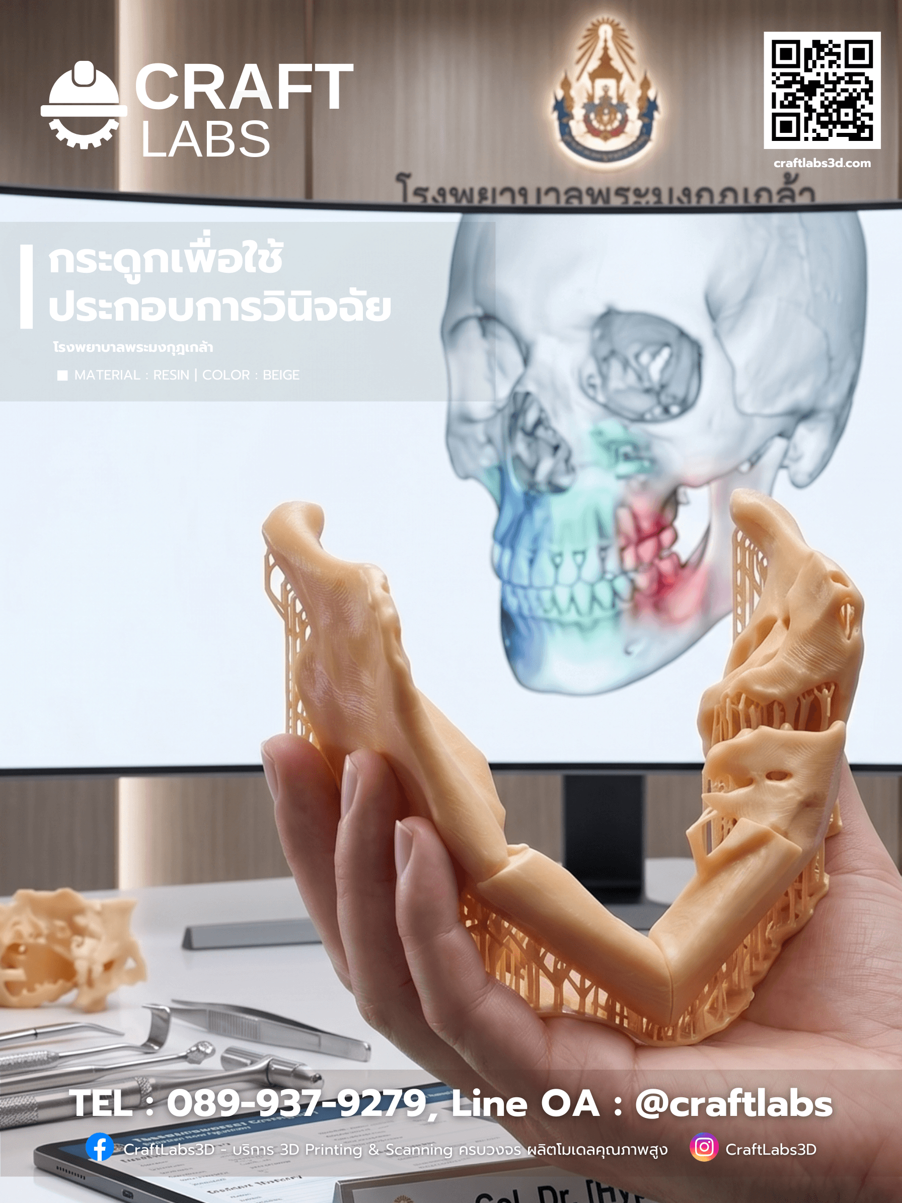 โชว์เคสงานพิมพ์ 3 มิติสำหรับทีมแพทย์ โรงพยาบาลพระมงกุฎเกล้า เพื่อใช้ประกอบการวินิจฉัยโรคและวางแผนการรักษาในเคสที่ซับซ้อน